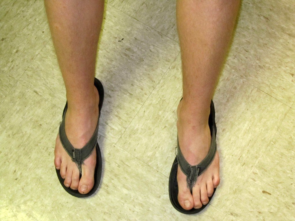 5. Flip-Flops and Overly Casual Shoes (Tobyotter, Flickr, CC BY 2.0)